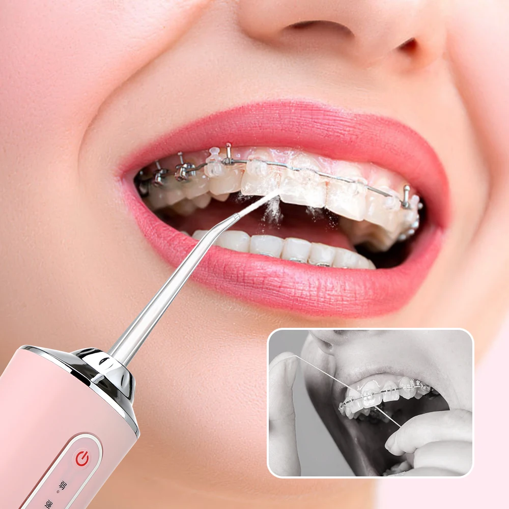 אוראלי משטף נייד שיניים מים Flosser USB נטענת סילון מים חוט דנטלי 4 Jet עצה 220ml 3 מצבים IPX7 1400 סל"ד – תמונה 2
