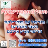 סובלים מפסוריאזיס? פסירילקס קרם פה כדי להקל!